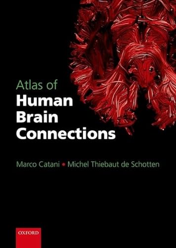 Atlas of Human Brain Connections von Oxford University Press
